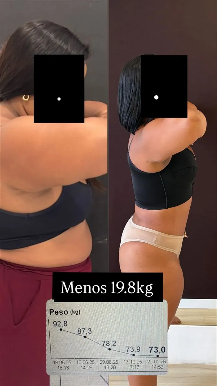 Antes e depois de paciente da Dra. Raquel, 19,8 kg a menos