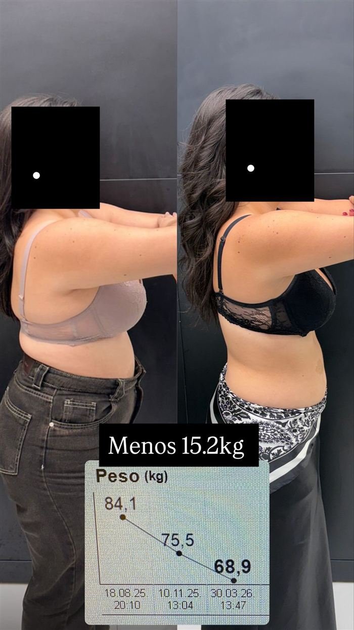 Antes e depois de paciente: menos 15,2 kg